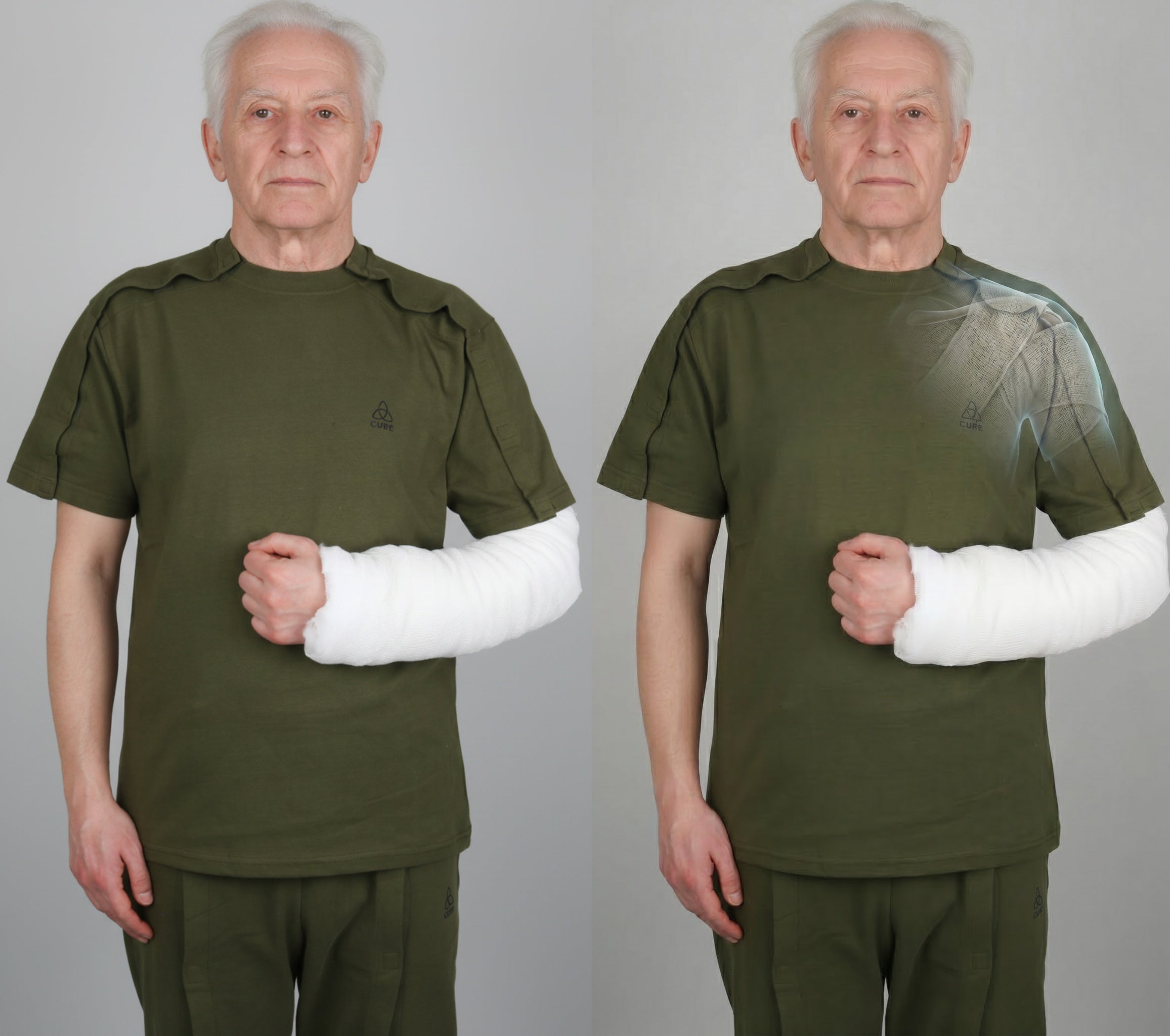Kırık Kol Askısı İle Tişört Giyme: İpuçları ve Pratik Çözümler