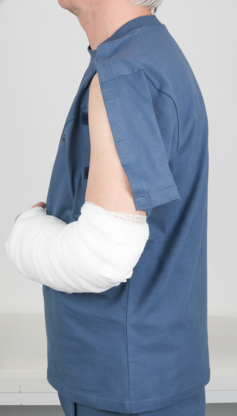 Cure Adaptive Short-Sleeved Fractured Arm - Orthopedic Treatment Garment