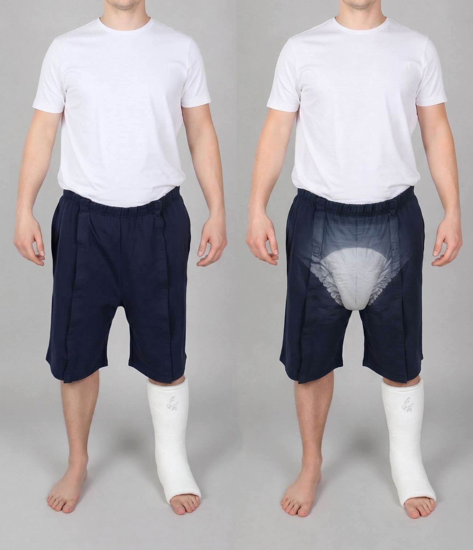 Cure Adaptive Bedridden Patient Care and Treatment Shorts - Velcro Closure
