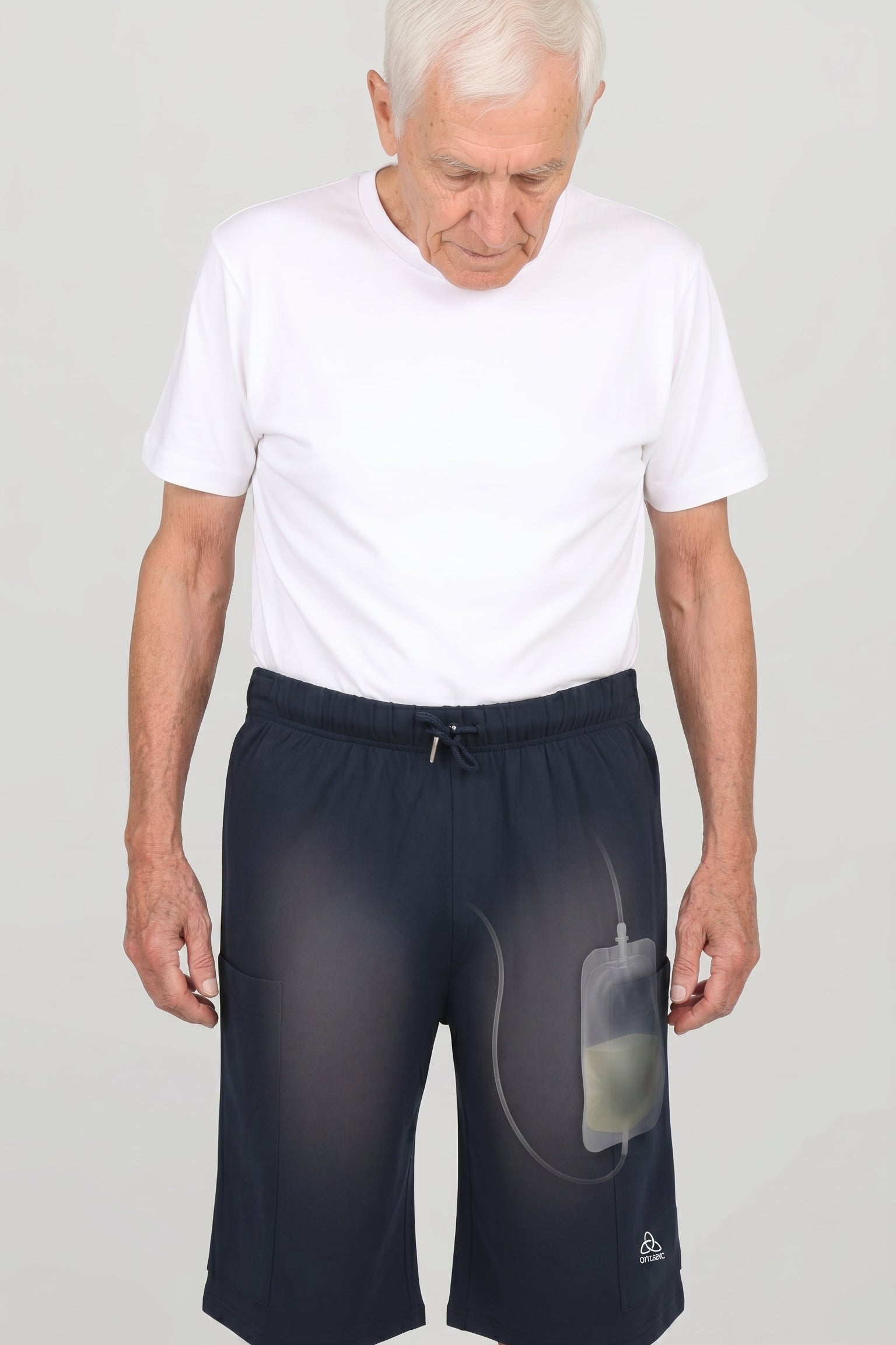 Cure Adaptive Prostate Patient Care and Treatment Shorts