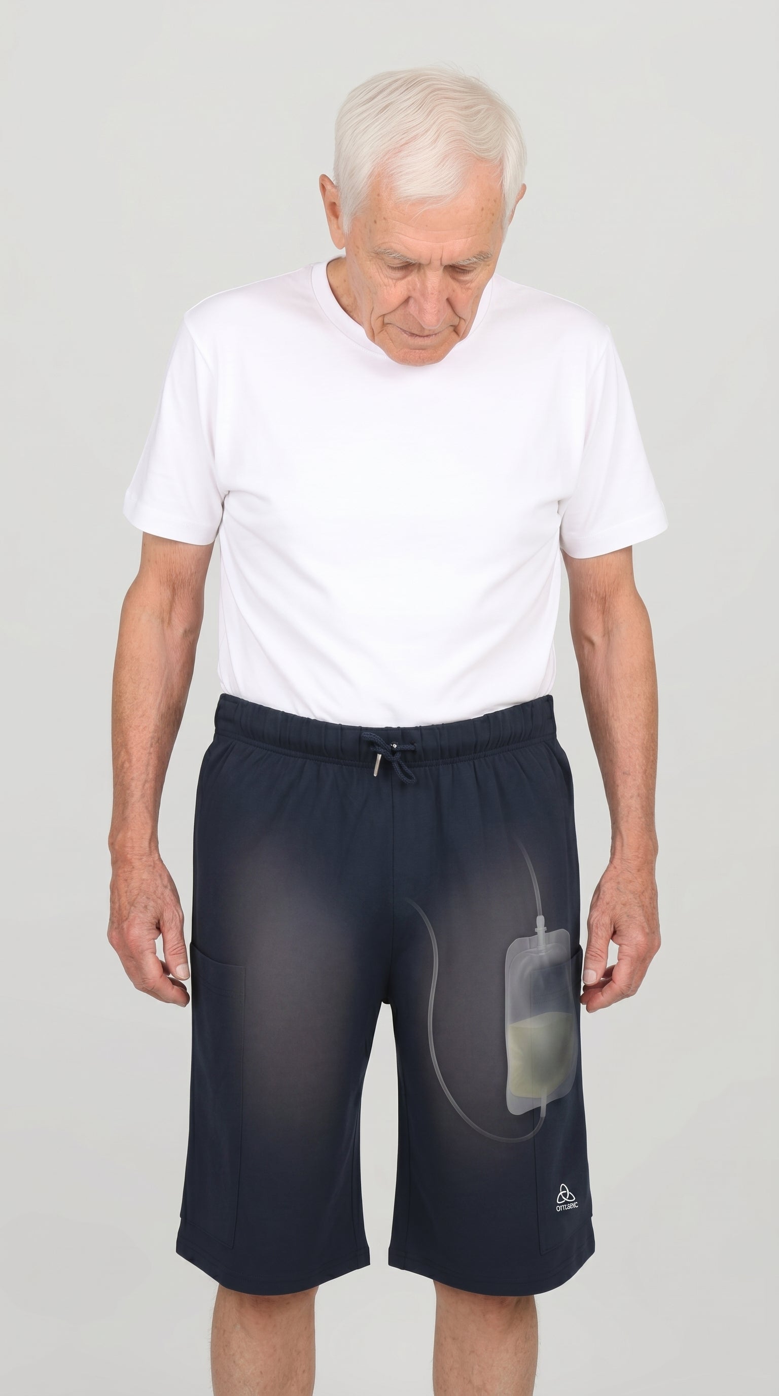 Cure Adaptive Prostate Patient Care and Treatment Shorts