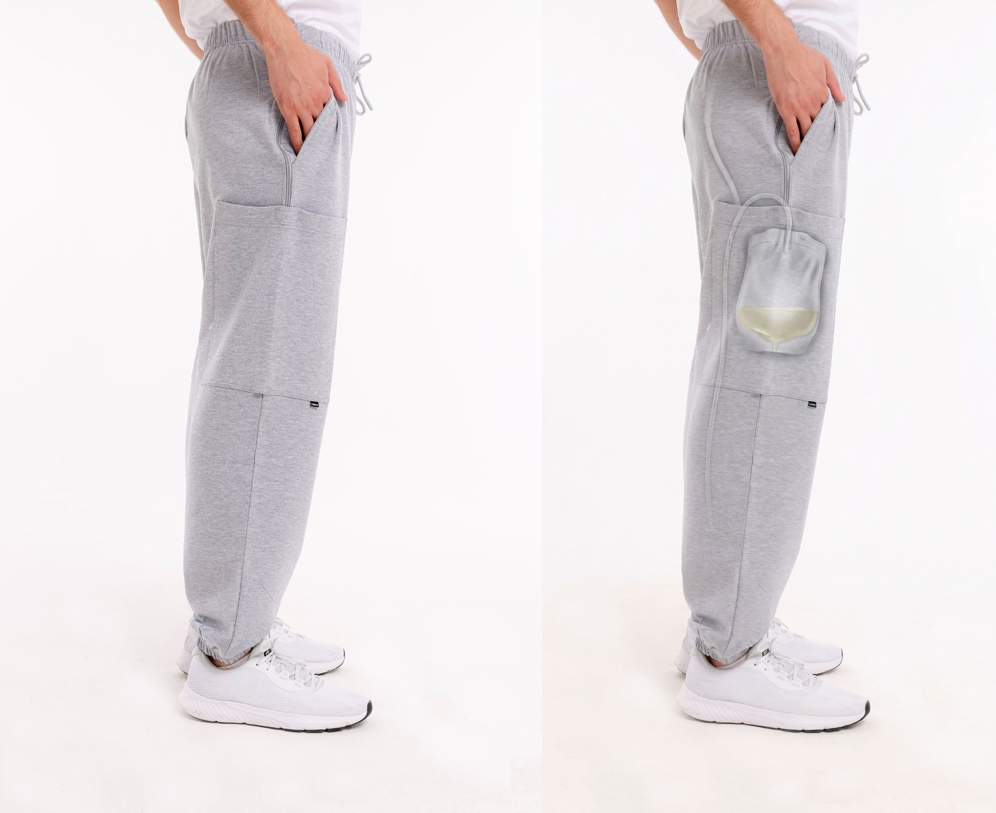 Cure Adaptive Prostate Patient Care and Treatment Pants