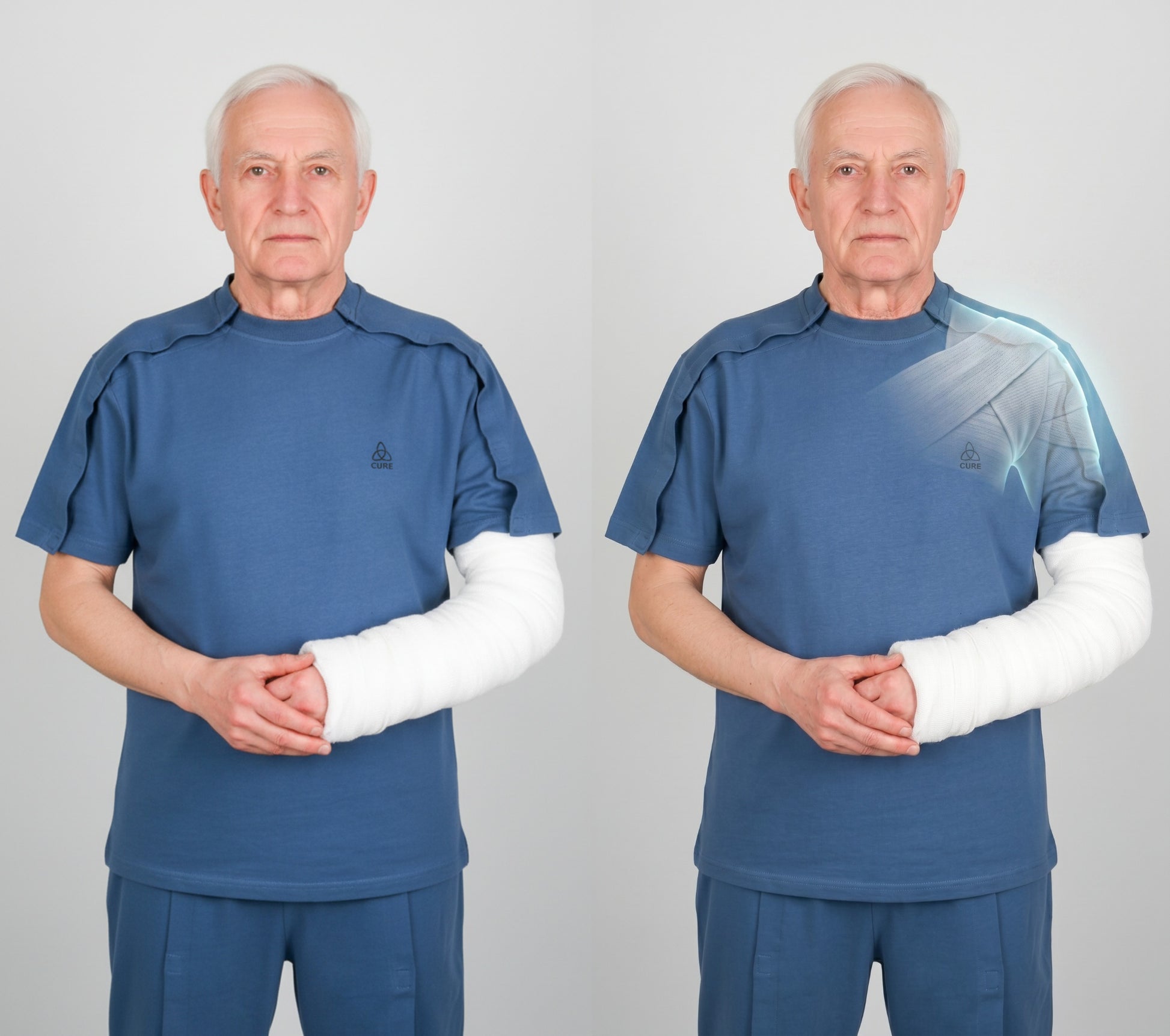 Cure Adaptive Short-Sleeved Fractured Arm - Orthopedic Treatment Garment