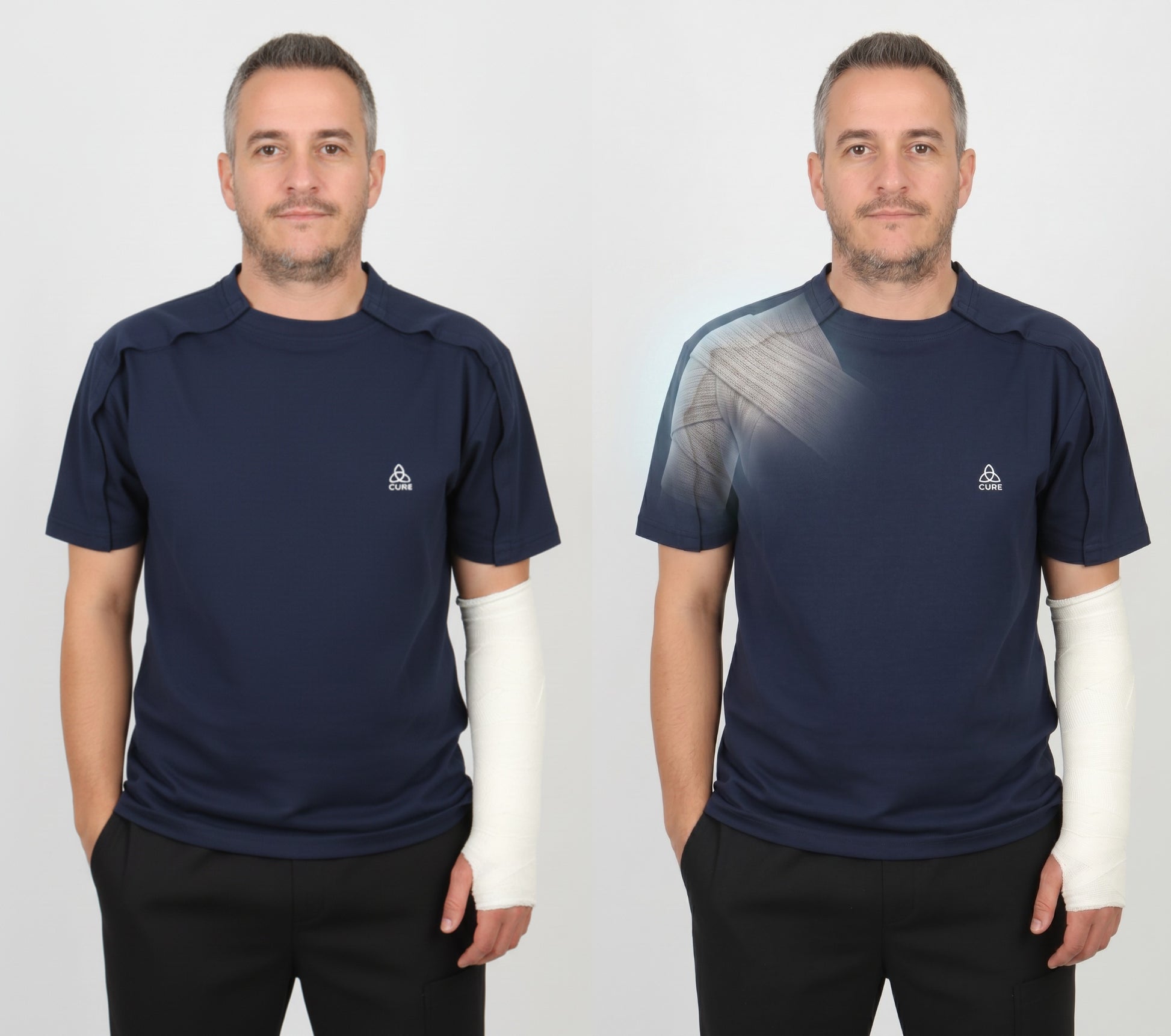Cure Adaptive Short-Sleeved Fractured Arm - Orthopedic Treatment Garment