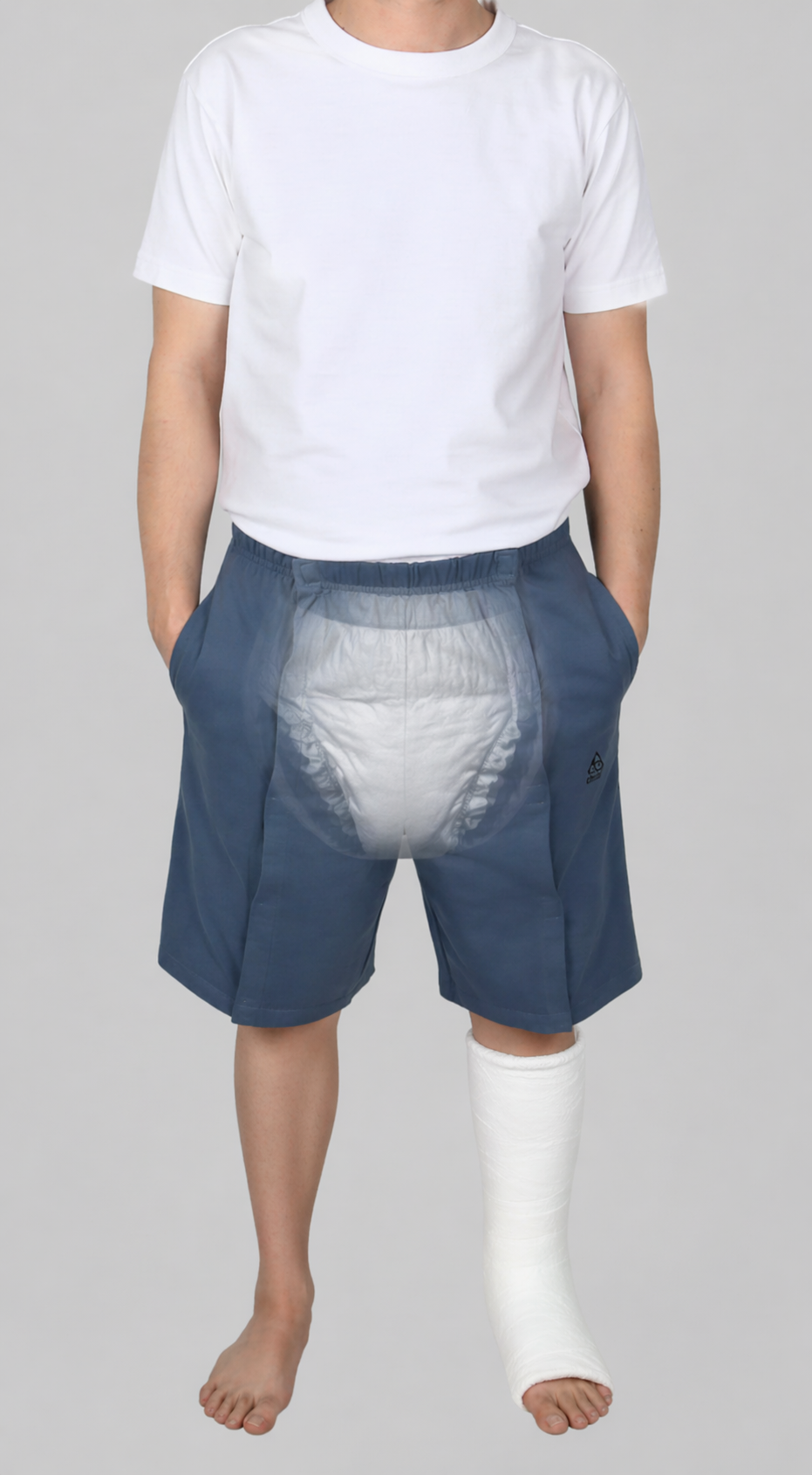 Cure Adaptive Bedridden Patient Care and Treatment Shorts - Velcro Closure