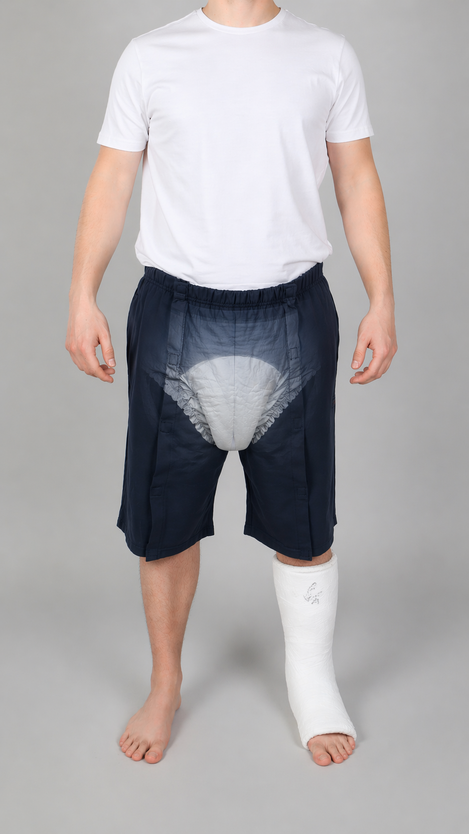 Cure Adaptive Bedridden Patient Care and Treatment Shorts - Velcro Closure